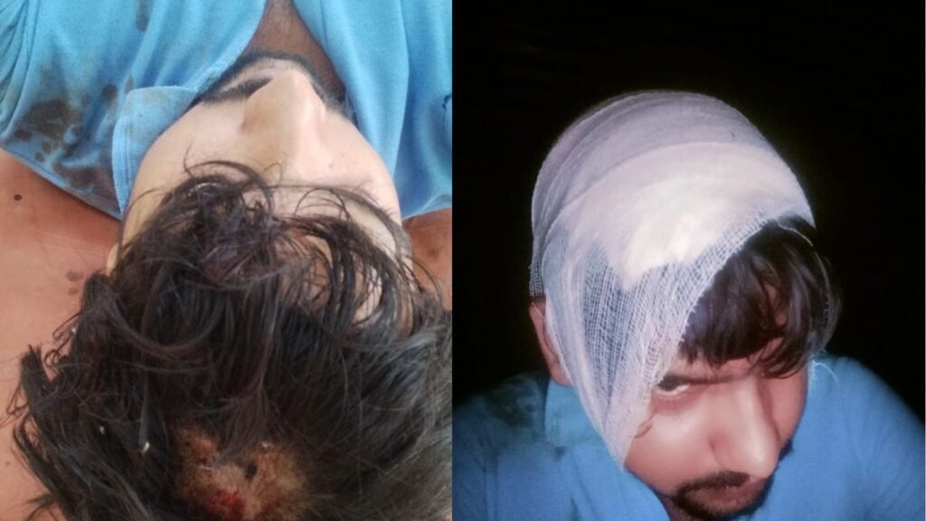 kanpur-minor-dispute-deadly-attack