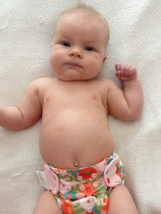 Tips to Prevent Diaper Rash in Babies (11)