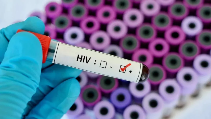 maharajganj-hiv-positive