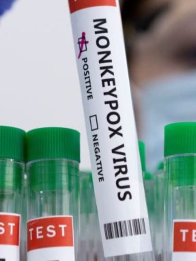 mpox-virus-transmission-symptoms-prevention-treatment