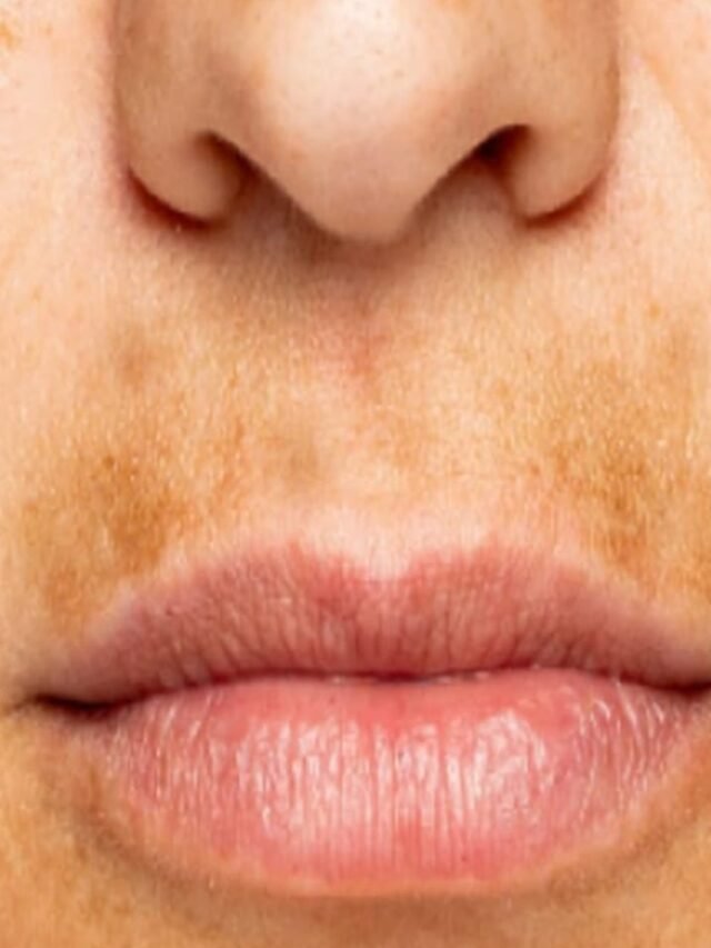 Remove Dark skin Around Lips Home Remedies In Hindi