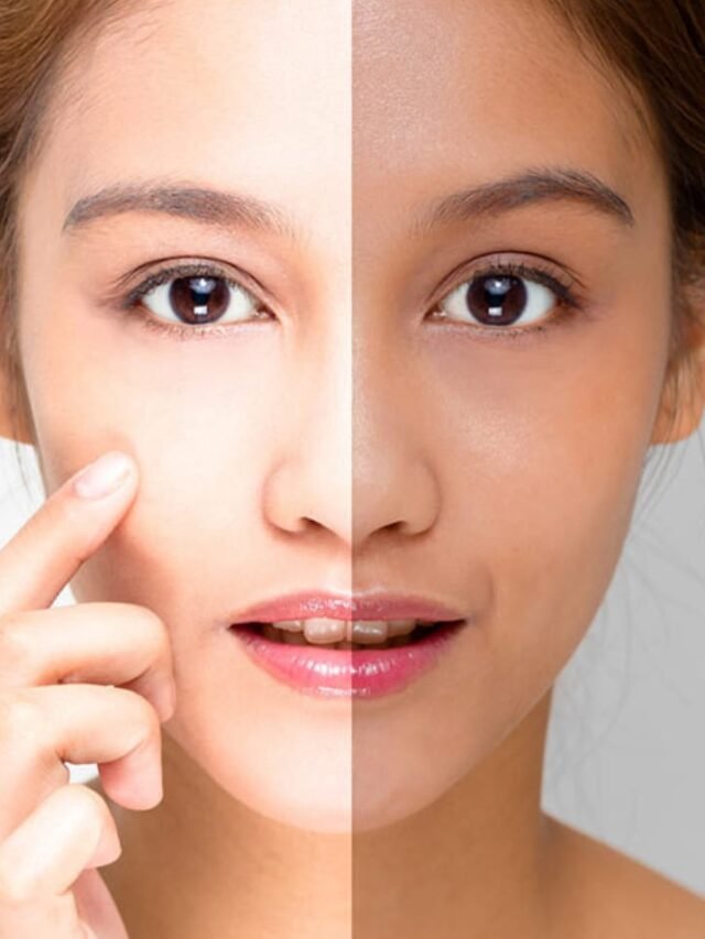 Vitamin Deficiency Dark Skin