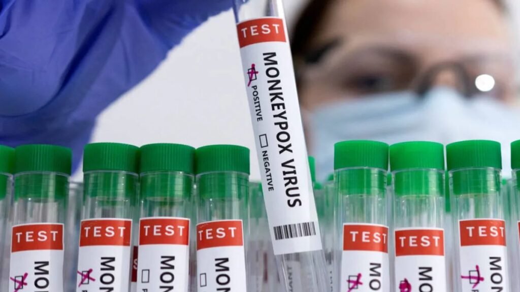 India में पहला संदिग्ध मंक्स (Mpox) केस दर्ज, पुरुष मरीज को आइसोलेशन में रखा गया