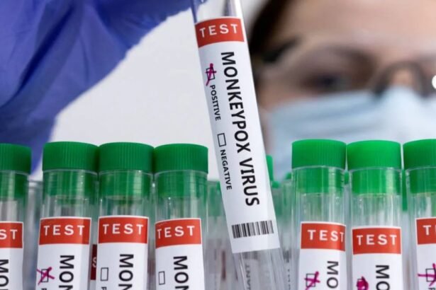 India में पहला संदिग्ध मंक्स (Mpox) केस दर्ज, पुरुष मरीज को आइसोलेशन में रखा गया