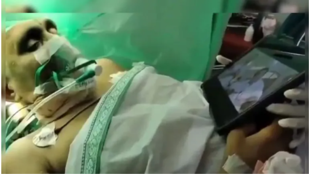 Viral Videos: महिला का हो रहा था ब्रेम ट्यूमर का ऑपरेशन और वो देख रही थी जूनियर NTR की फिल्म, वीडियो हुआ वायरल