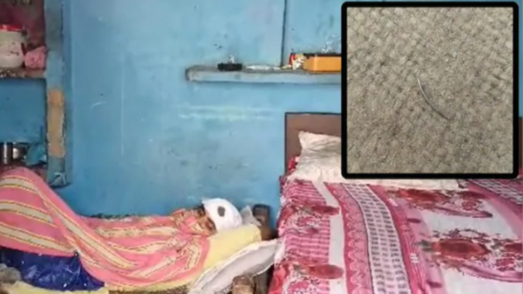 Hapur: डॉक्टरों की लापरवाही, सिर में टांके लगाते समय छोड़ी सुई