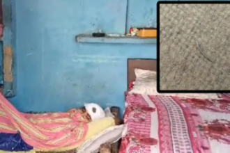 Hapur: डॉक्टरों की लापरवाही, सिर में टांके लगाते समय छोड़ी सुई