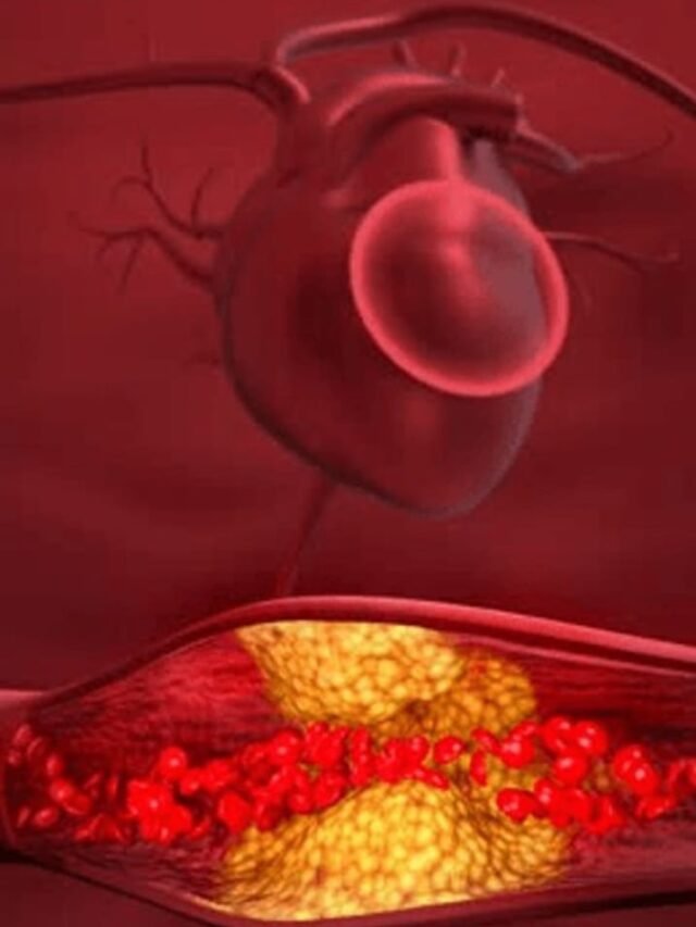 drinks to reduce high cholesterol