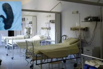 puducherry girl stomach hairball